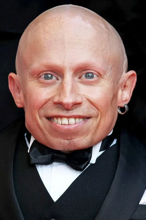 фото Verne Troyer