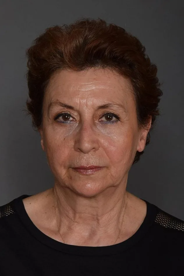 foto de Serra Menderes