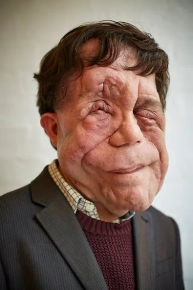 صورة Adam Pearson