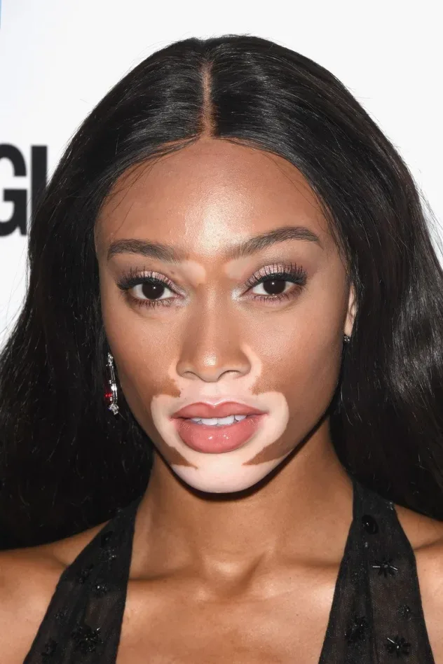 صورة الغلاف لـ Winnie Harlow