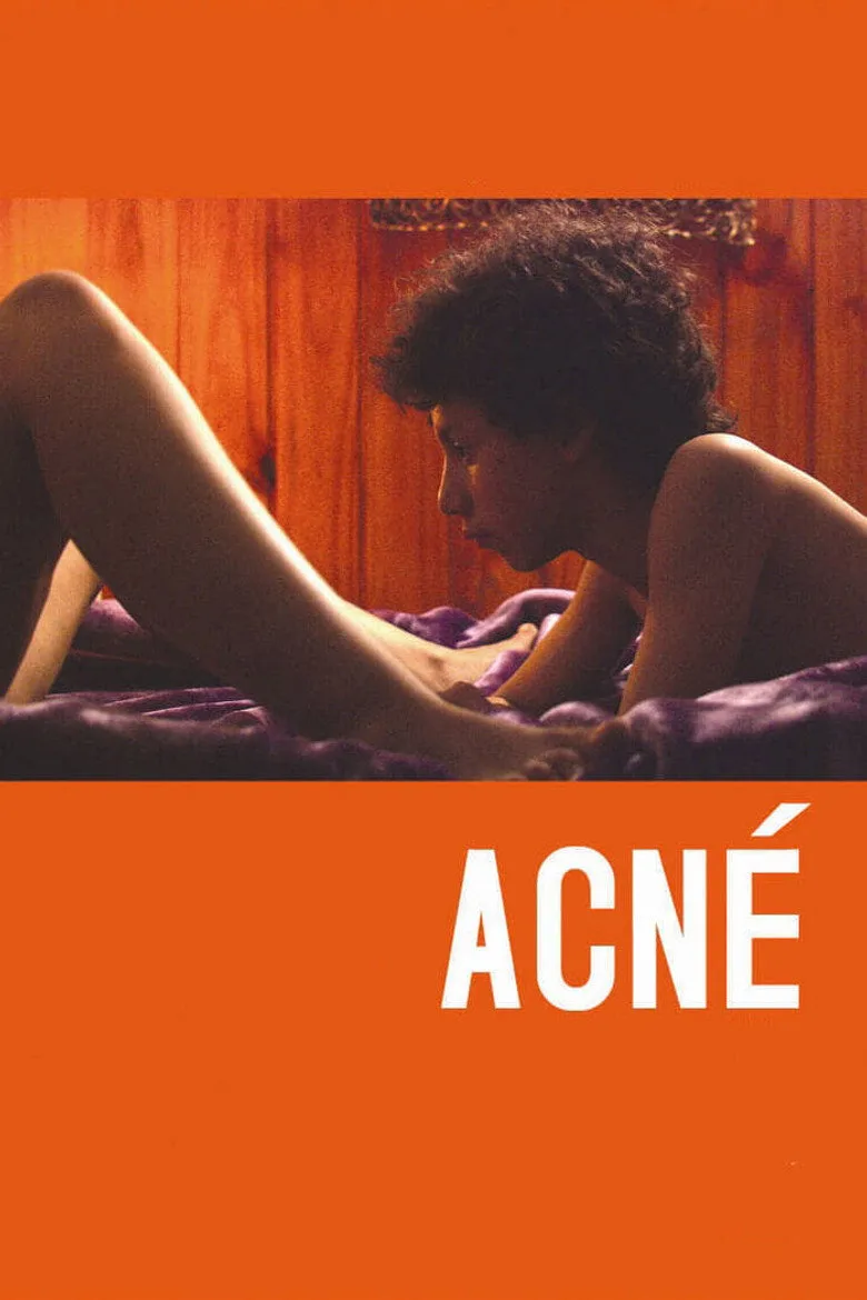 Acné poster